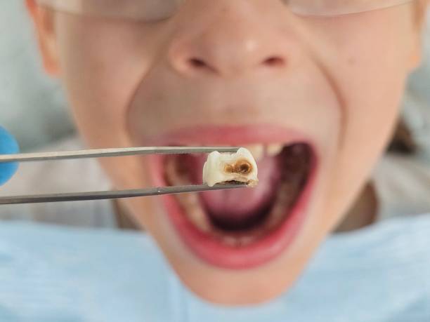 Best Emergency Dental Surgery in Clinton, IL